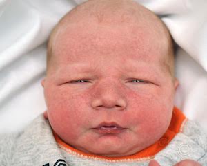 A baby with a very big forehead and eyes closed.