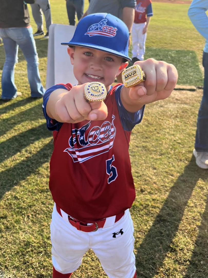 A young boy holding up his medal in the park.